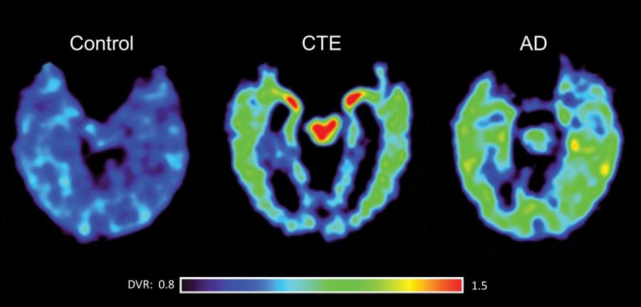 What+are+the+effects+of+contact+sports+on+mental+health%3F